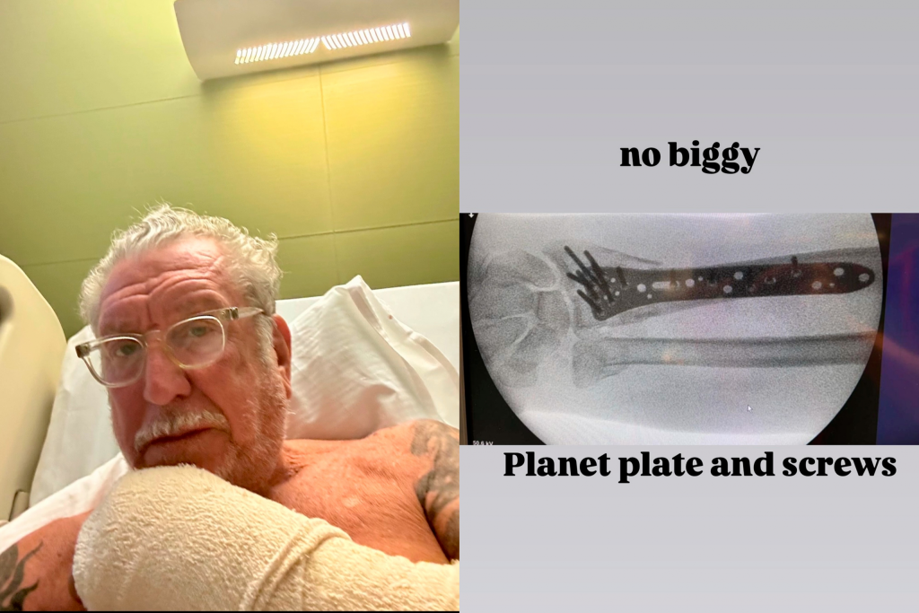 Guitarrista do Sex Pistols publica fotos de pulso quebrado após banda cancelar show no The Town